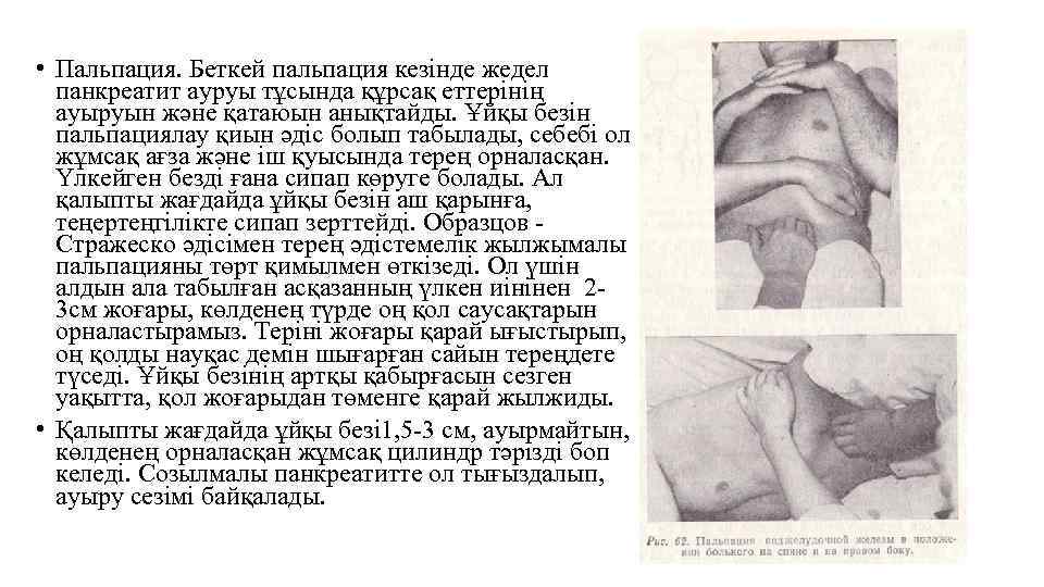  • Пальпация. Беткей пальпация кезінде жедел панкреатит ауруы тұсында құрсақ еттерінің ауыруын және