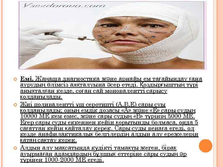  Емі. Жаңаша диагностика және арнайы ем тағайындау ғана аурудың өлімсіз аяқталуына әсер етеді.