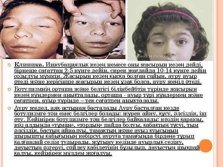  Клиника. Инкубациялық кезең немесе оны жасырын кезең дейді, бірнеше сағаттан 2 -5 күнге