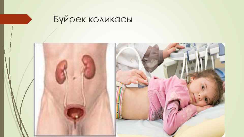Бүйрек коликасы 