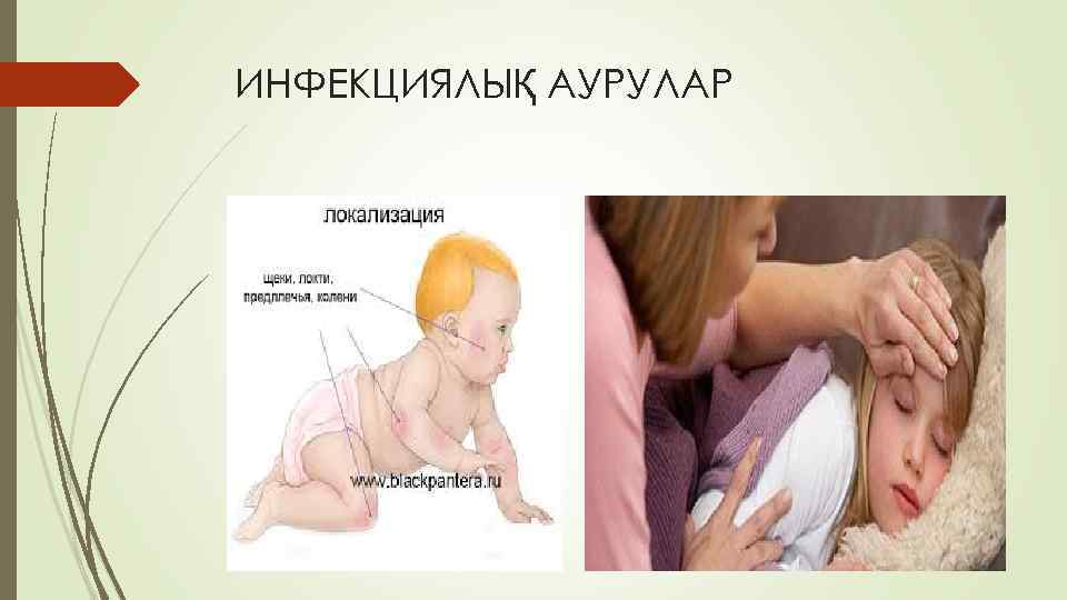 ИНФЕКЦИЯЛЫҚ АУРУЛАР 