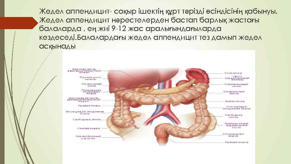Жедел аппендицит- соқыр ішектің құрт тәрізді өсіндісінің қабынуы. Жедел аппендицит нәрестелерден бастап барлық жастағы