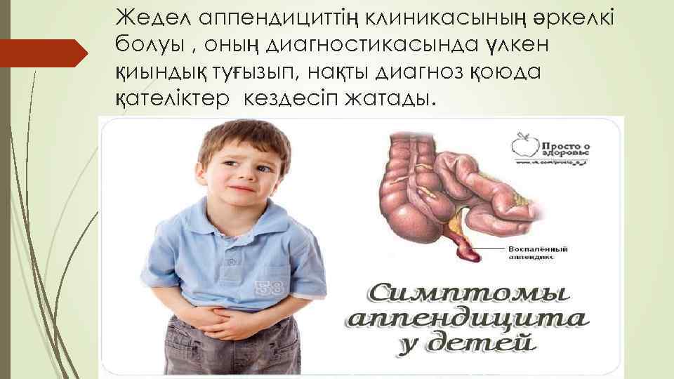 Жедел аппендициттің клиникасының әркелкі болуы , оның диагностикасында үлкен қиындық туғызып, нақты диагноз қоюда