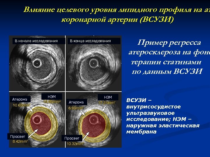 Исследование коронарного кальция