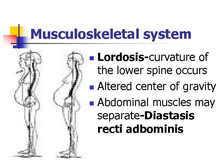 Musculoskeletal system Lordosis-curvature of the lower spine occurs n Altered center of gravity n