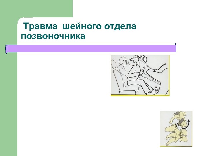 Травма шейного отдела позвоночника 