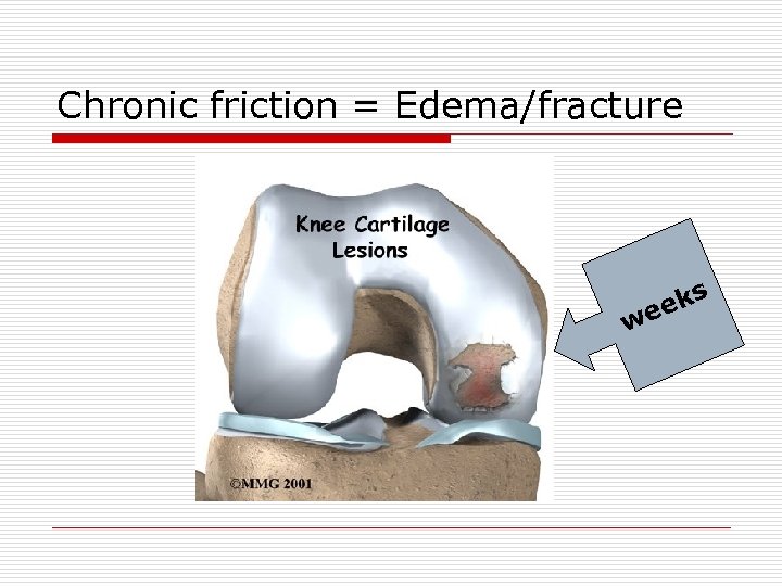 Chronic friction = Edema/fracture w s ek e 