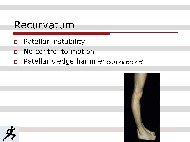 Recurvatum o o o Patellar instability No control to motion Patellar sledge hammer (outside