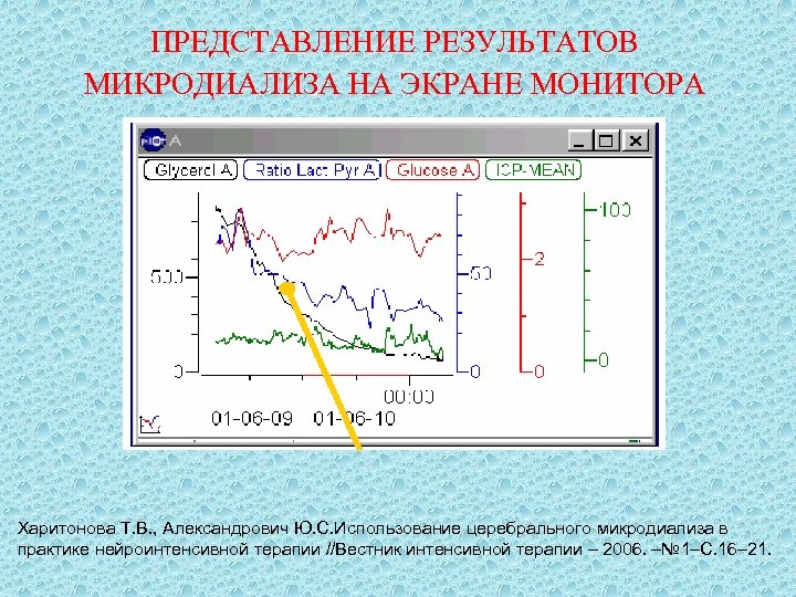 ПРЕДСТАВЛЕНИЕ РЕЗУЛЬТАТОВ МИКРОДИАЛИЗА НА ЭКРАНЕ МОНИТОРА Харитонова Т. В. , Александрович Ю. С. Использование