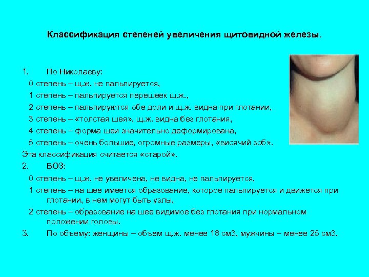 Классификация степеней увеличения щитовидной железы. 1. По Николаеву: 0 степень – щ. ж. не