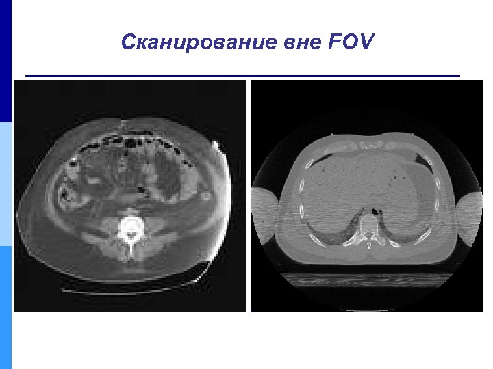 Сканирование вне FOV 