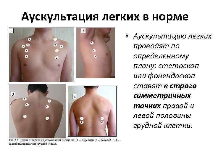 Аускультация легких в норме • Аускультацию легких проводят по определенному плану: стетоскоп или фонендоскоп