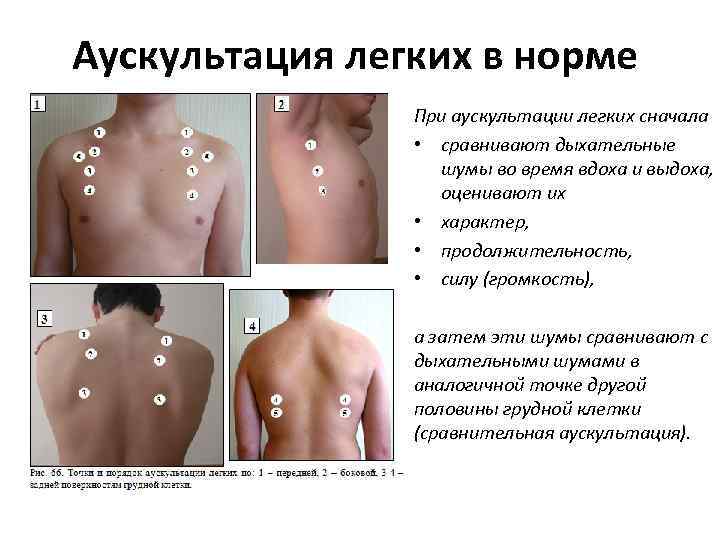 Аускультация легких в норме При аускультации легких сначала • сравнивают дыхательные шумы во время