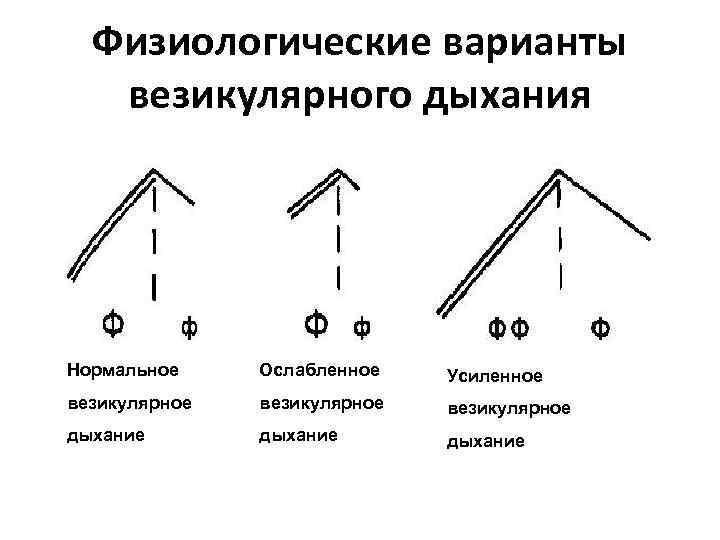 Физиологические варианты везикулярного дыхания Нормальное Ослабленное Усиленное везикулярное дыхание 