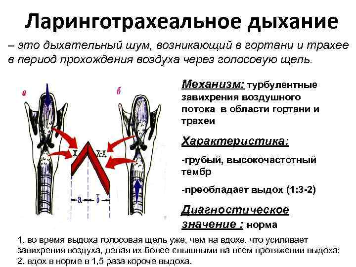 Ларинготрахеальное дыхание – это дыхательный шум, возникающий в гортани и трахее в период прохождения