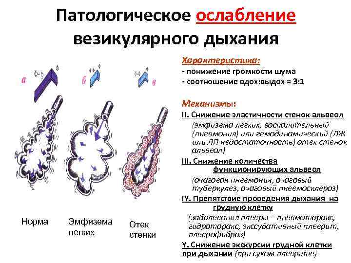 Патологическое ослабление везикулярного дыхания Характеристика: - понижение громкости шума - соотношение вдох: выдох =