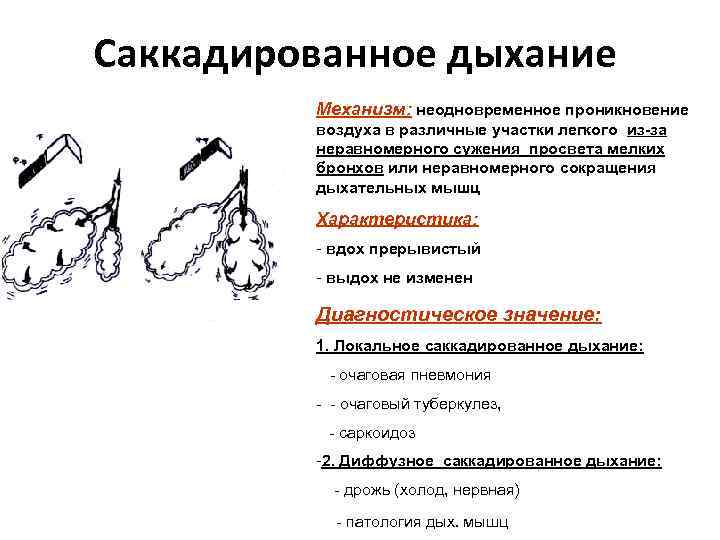 Саккадированное дыхание Механизм: неодновременное проникновение воздуха в различные участки легкого из-за неравномерного сужения просвета