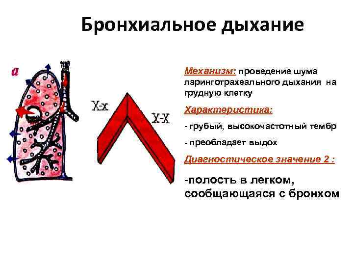 Бронхиальное дыхание Механизм: проведение шума ларинготрахеального дыхания на грудную клетку Характеристика: - грубый, высокочастотный