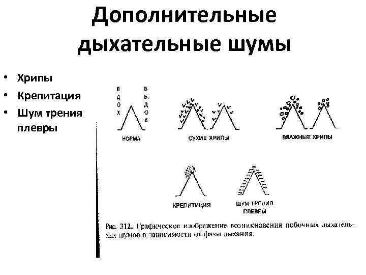 Дополнительные дыхательные шумы • Хрипы • Крепитация • Шум трения плевры 