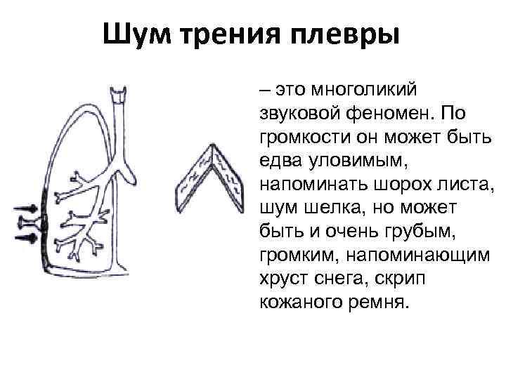 Шум трения плевры – это многоликий звуковой феномен. По громкости он может быть едва