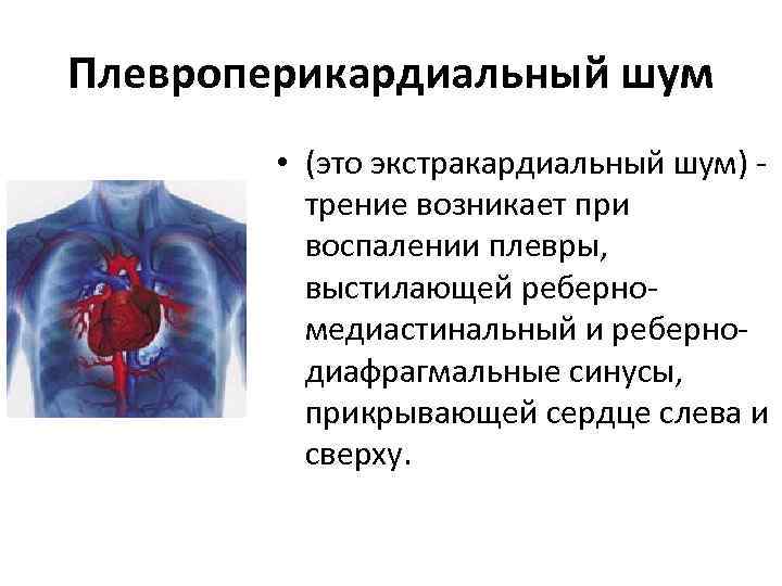 Плевроперикардиальный шум • (это экстракардиальный шум) трение возникает при воспалении плевры, выстилающей реберномедиастинальный и