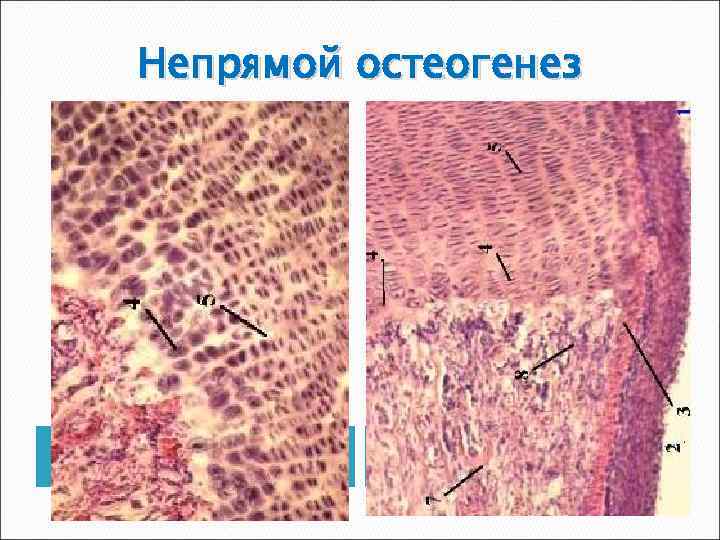 Непрямой остеогенез схема