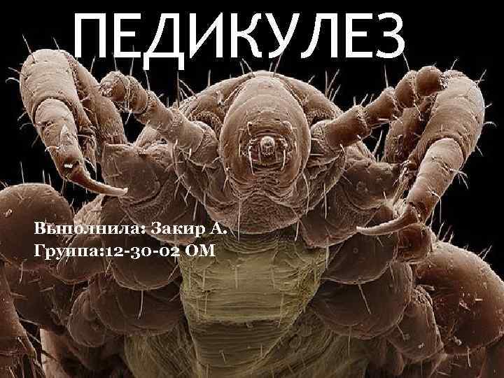 ПЕДИКУЛЕЗ Выполнила: Закир А. Группа: 12 -30 -02 ОМ 
