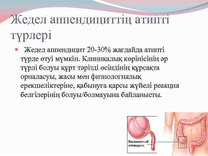 Жедел аппендициттің атипті түрлері Жедел аппендицит 20 -30% жағдайда атипті түрде өтуі мүмкін. Клиникалық