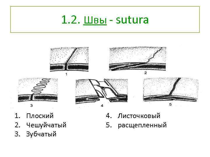 1. 2. Швы - sutura 1. Плоский 2. Чешуйчатый 3. Зубчатый 4. Листочковый 5.