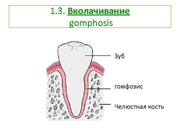 1. 3. Вколачивание gomphosis Зуб гомфозис Челюстная кость 