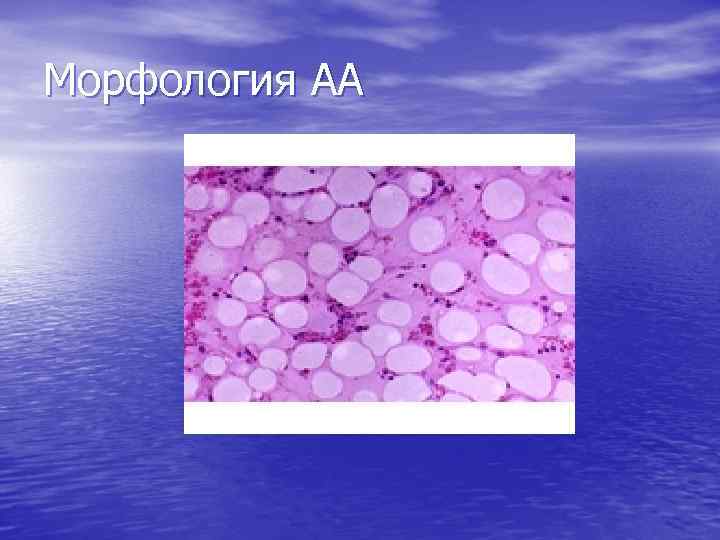 Морфология АА 