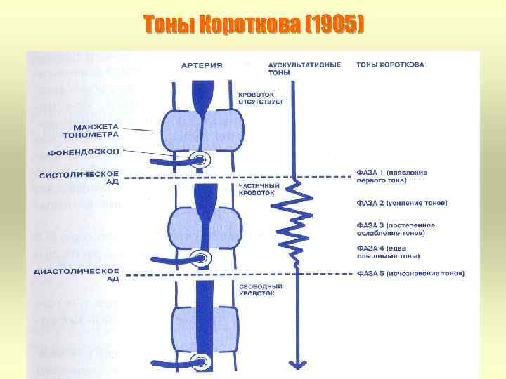 Тоны Короткова (1905) 