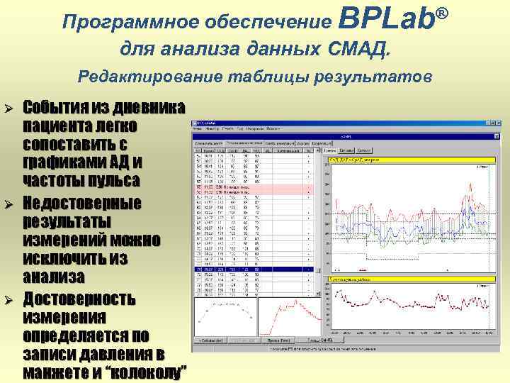 ® Программное обеспечение BPLab для анализа данных СМАД. Редактирование таблицы результатов Ø Ø Ø