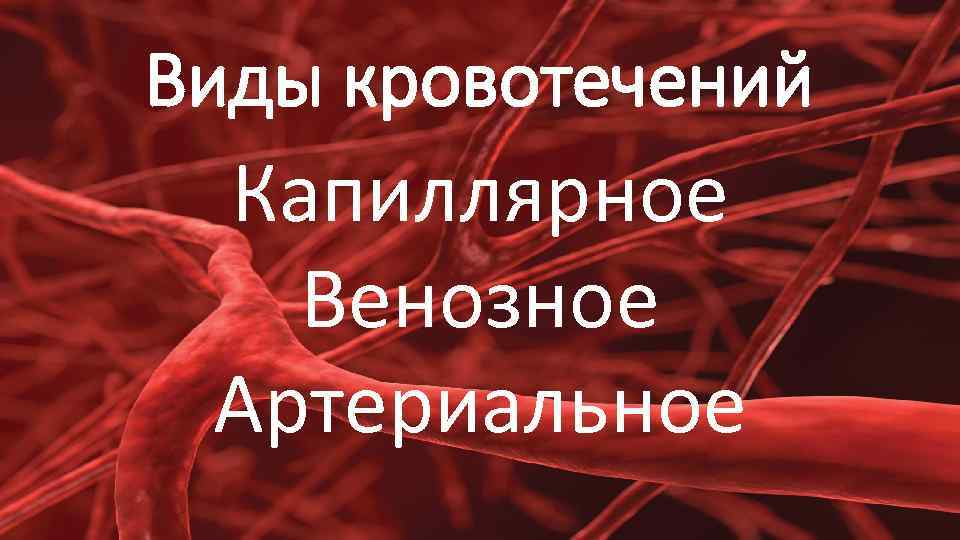Виды кровотечений Капиллярное Венозное Артериальное 