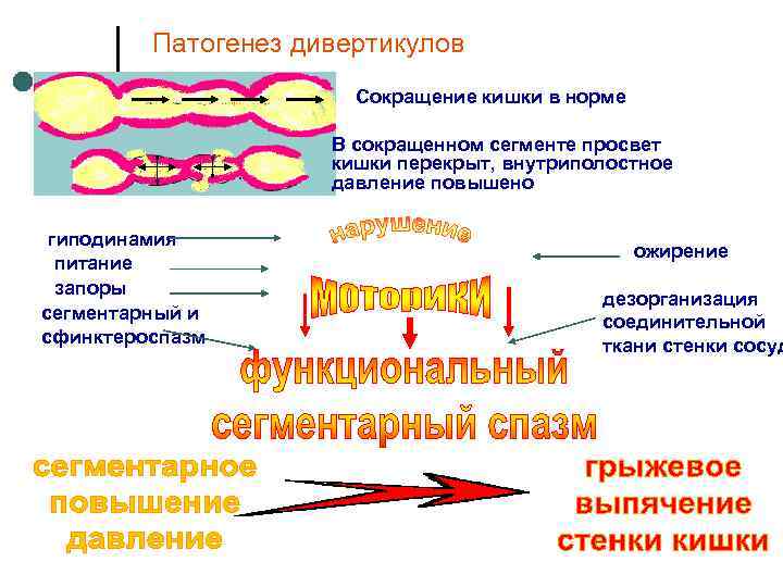 Схема лечения дивертикулита кишечника