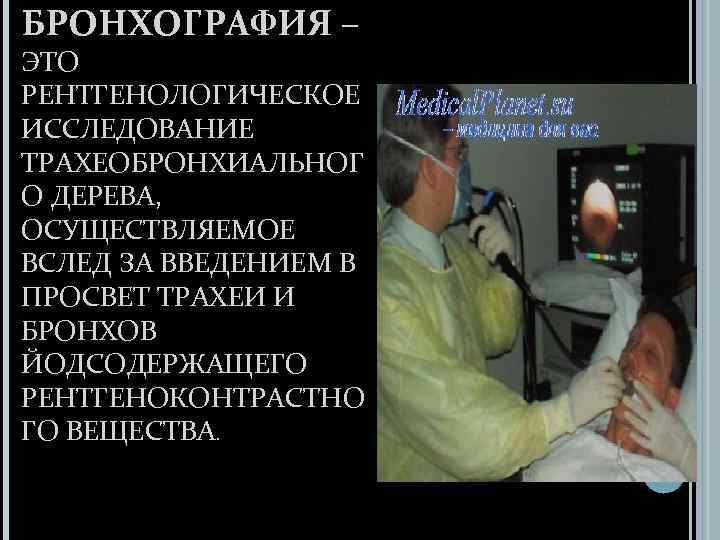 БРОНХОГРАФИЯ – ЭТО РЕНТГЕНОЛОГИЧЕСКОЕ ИССЛЕДОВАНИЕ ТРАХЕОБРОНХИАЛЬНОГ О ДЕРЕВА, ОСУЩЕСТВЛЯЕМОЕ ВСЛЕД ЗА ВВЕДЕНИЕМ В ПРОСВЕТ