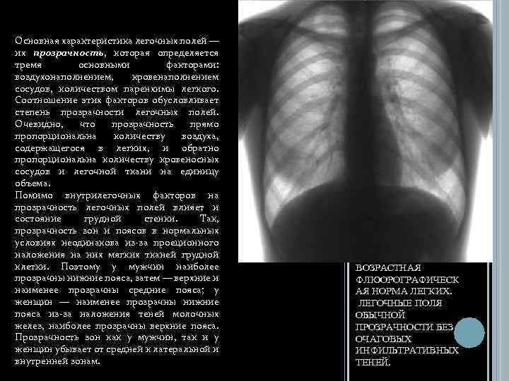 Основная характеристика легочных полей — их прозрачность, которая определяется тремя основными факторами: воздухонаполнением, кровенаполнением