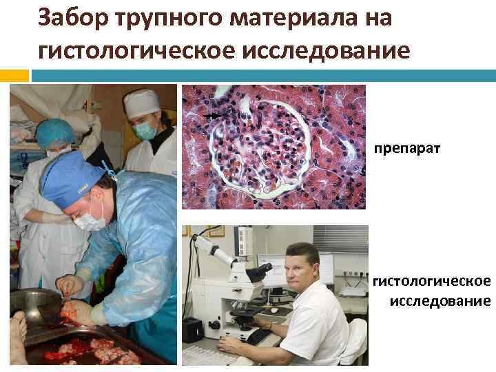 Забор трупного материала на гистологическое исследование препарат гистологическое исследование 