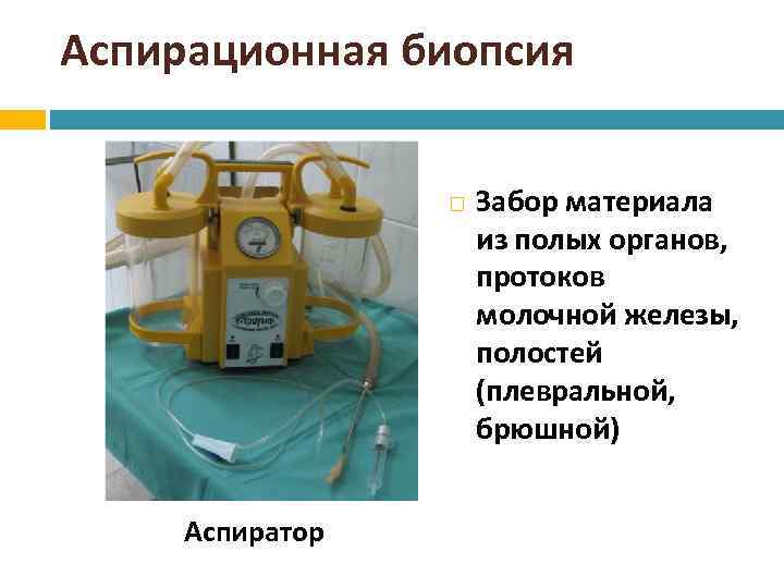 Аспирационная биопсия Аспиратор Забор материала из полых органов, протоков молочной железы, полостей (плевральной, брюшной)