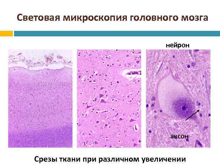 Световая микроскопия головного мозга нейрон аксон Срезы ткани при различном увеличении 