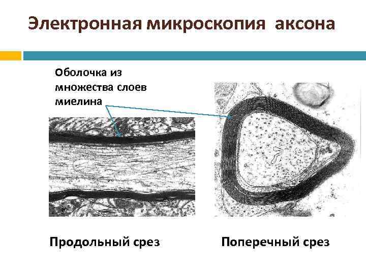 Электронная микроскопия аксона Оболочка из множества слоев миелина Продольный срез Поперечный срез 