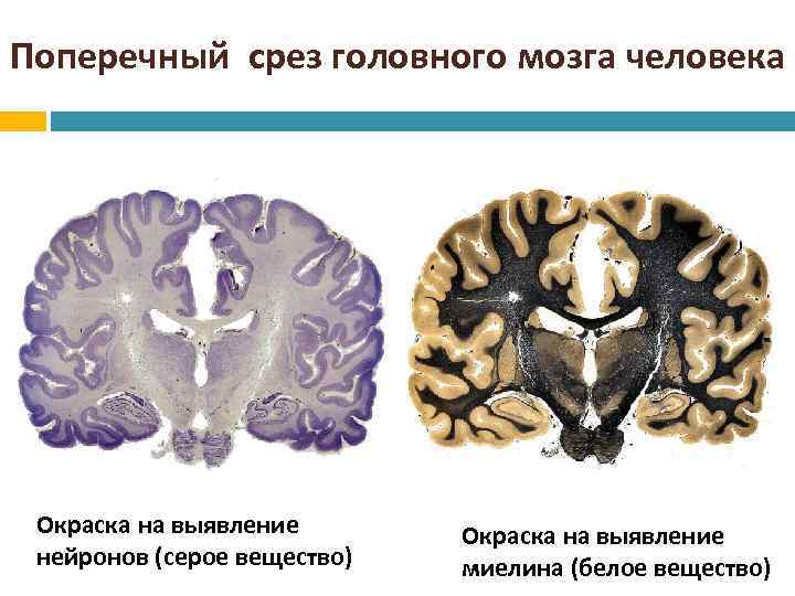 Поперечный срез головного мозга человека Окраска на выявление нейронов (серое вещество) Окраска на выявление