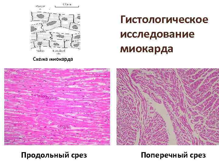 Миокард гистология рисунок