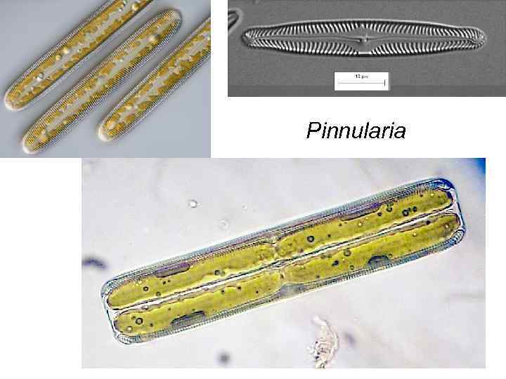 Pinnularia 