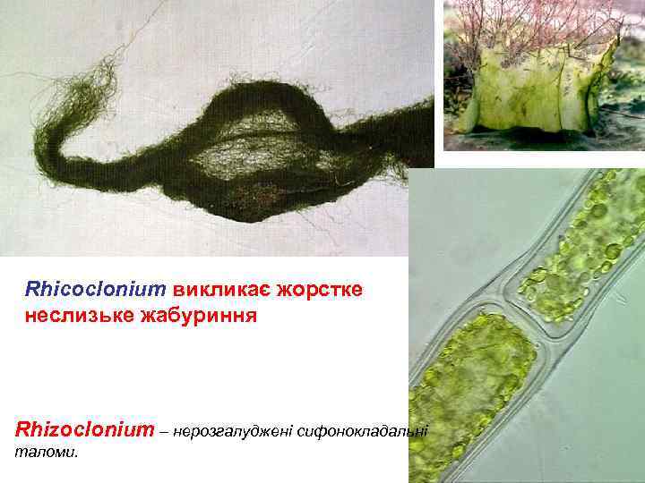 Rhicoclonium викликає жорстке неслизьке жабуриння Rhizoclonium – нерозгалуджені сифонокладальні таломи. 