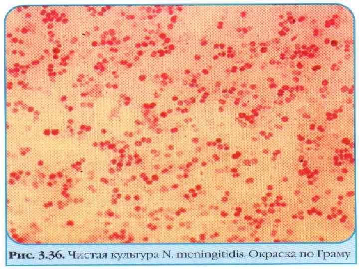 Chlamydia trachomatis neisseria gonorrhoeae. Менингококки Neisseria meningitidis. Менингококк окраска по Граму. Менингококк микробиология культура. Neisseria meningitis чистая культура.