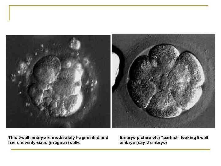 This 5 -cell embryo is moderately fragmented and has unevenly sized (irregular) cells Embryo