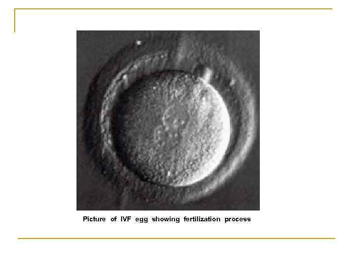 Picture of IVF egg showing fertilization process 