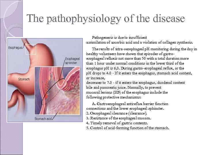 The pathophysiology of the disease Pathogenesis is due to insufficient assimilation of ascorbic acid