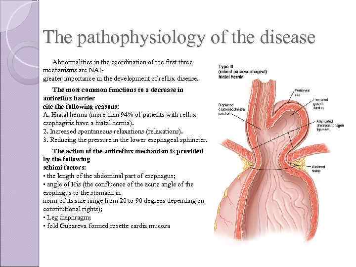 The pathophysiology of the disease Abnormalities in the coordination of the first three mechanisms